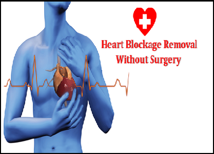 Dr. Rahul Patil - Best cardiologist in Pune