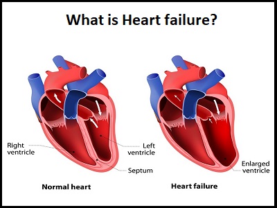 Dr. Rahul Patil - Best Cardiologist in Pune